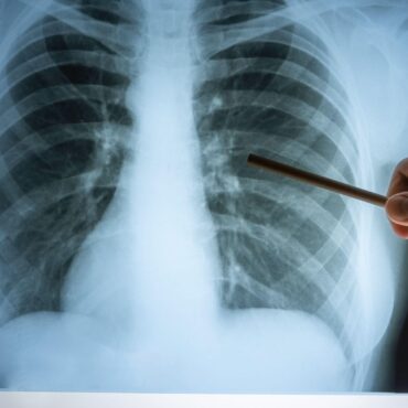 Children With Cancer To Have Travel Costs Paid Under New Government Scheme