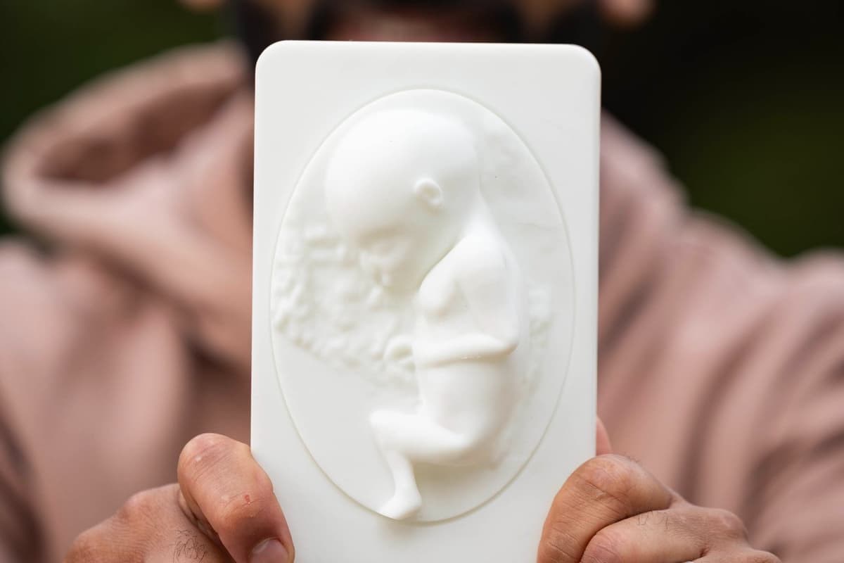 New Pilot To Turn Ultrasounds Into 3D Printed Moulds For Parents With Sight Loss