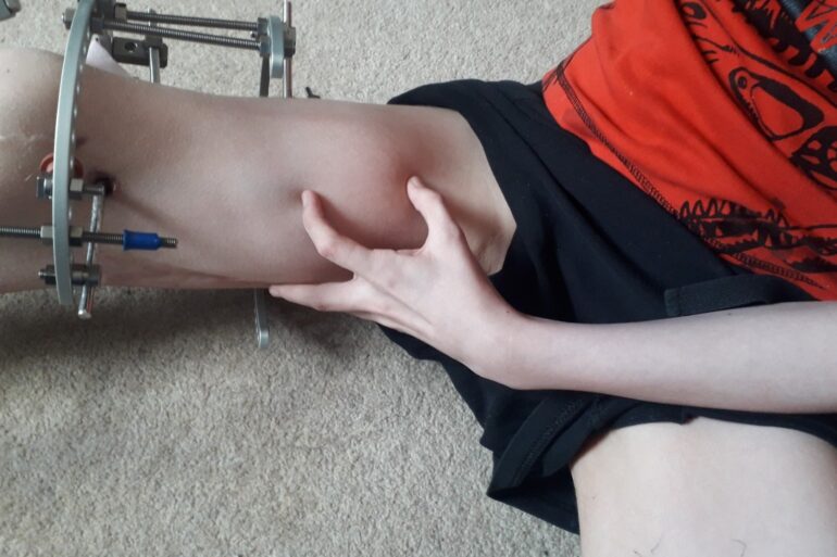 94 Patients Were Harmed By Great Ormond Street Surgeon Review Finds